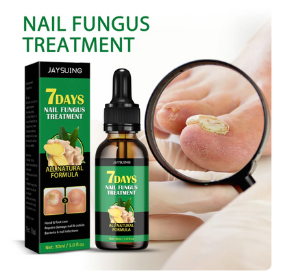 Seven Days Nail Fungus® - Tratamiento para Hongos
